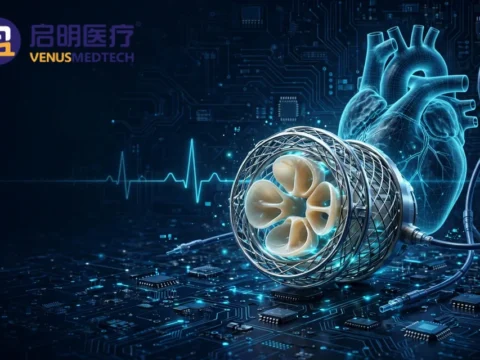 中国结构性心脏病介入器械领军企业：启明医疗 Venus Medtech (Hangzhou) Inc.(2500)