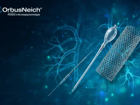 全球血管介入医疗器械制造商：业聚医疗集团控股 OrbusNeich Medical Group Holdings Limited(6929)